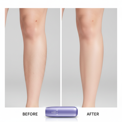 LaserVela™ PureGlow IPL