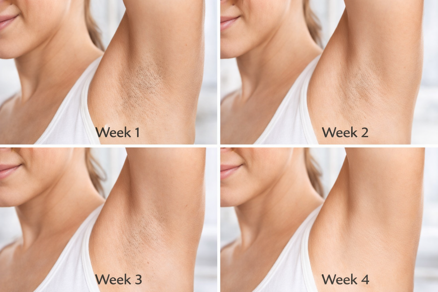 LaserVela™ PureGlow IPL