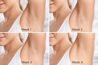 LaserVela™ PureGlow IPL